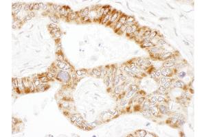 anti-Propionyl CoA Carboxylase, alpha Polypeptide (PCCA) (AA 678-728) antibody
