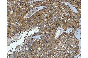 IHC analysis of CAD using anti-CAD antibody (ABIN7600044).