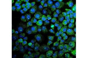 IF analysis of MAPK11 using anti-MAPK11 antibody (ABIN7600772). (MAPK11 抗体  (AA 230-364))