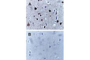 Formalin-fixed, paraffin-embedded human brain sections stained for Active/Cleaved CASP9 expression using CASP9 polyclonal antibody  at 1 : 2000. (Caspase 9 抗体)