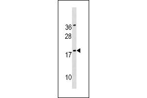 SNX12 Antibody (Center) (ABIN1881820 and ABIN2843219) western blot analysis in  cell line lysates (35 μg/lane). (SNX12 抗体  (AA 84-112))
