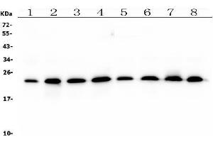 Western blot analysis of RAB11B using anti-RAB11B antibody (ABIN7602766).