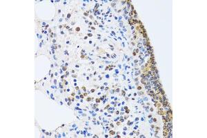 Immunohistochemistry of paraffin-embedded rat lung using MTA3 antibody (ABIN2737194) at dilution of 1:100 (40x lens). (MTA3 抗体)