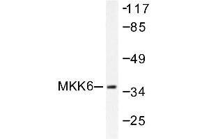 Image no. 1 for anti-Mitogen-Activated Protein Kinase Kinase 6 (MAP2K6) antibody (ABIN265521) (MAP2K6 抗体)