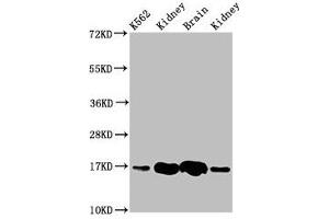 Western Blot Positive WB detected in: K562 whole cell lysate, Rat kideny tissue, Rat brain tissue, Mouse kidney tissue All lanes: HBG2 antibody at 4. (HBG2 抗体  (AA 2-147))