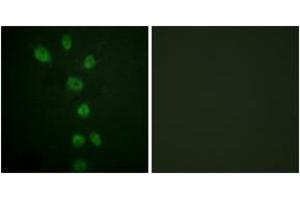 Immunofluorescence analysis of HepG2 cells, using GATA4 (Phospho-Ser105) Antibody. (GATA4 抗体  (pSer105))