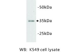 Image no. 1 for anti-Lactate Dehydrogenase A (LDHA) antibody (ABIN1112818)