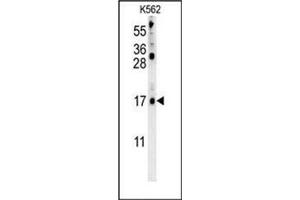 Western blot analysis of LCE2B Antibody (C-term) in K562 cell line lysates (35ug/lane). (LCE2B 抗体  (C-Term))