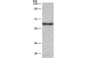 Western blot analysis of Mouse liver tissue, using SIGLEC5 Polyclonal Antibody at dilution of 1:350 (SIGLEC5 抗体)