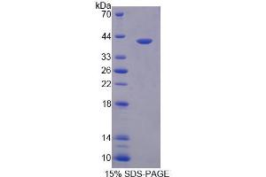 SDS-PAGE analysis of Mouse TST Protein.