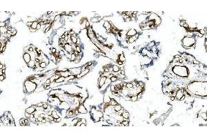 IHC analysis of CD146 using anti-CD146 antibody (ABIN7602097).