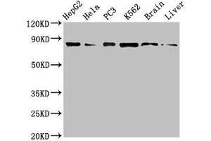 Western Blot Positive WB detected in: HepG2 whole cell lysate, Hela whole cell lysate, PC-3 whole cell lysate, K562 whole cell lyaste, Mouse brain tissue, Rat liver tissue All lanes: STAT4 antibody at 1 μg/mL Secondary Goat polyclonal to rabbit IgG at 1/50000 dilution Predicted band size: 86 kDa Observed band size: 86 kDa (STAT4 抗体  (AA 569-748))