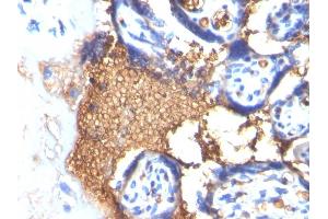 Immunohistochemistry (IHC) image for anti-Glycophorin A (GYPA) antibody (ABIN6939583)