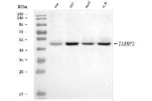 Western blot analysis of TRBP/TARBP2 using anti-TRBP/TARBP2 antibody (ABIN7600548).