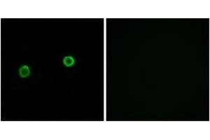 Immunofluorescence analysis of MCF7 cells, using ACOT4 Antibody. (ACOT4 抗体  (AA 361-410))