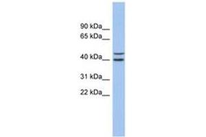 Image no. 1 for anti-F-Box and Leucine-Rich Repeat Protein 14 (FBXL14) (AA 35-84) antibody (ABIN6743688) (FBXL14 抗体  (AA 35-84))