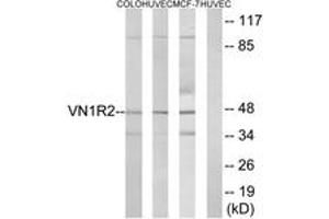 Western blot analysis of extracts from HuvEc/COLO/MCF-7 cells, using VN1R2 Antibody. (VN1R2 抗体  (AA 88-137))