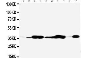 Anti-Annexin V antibody, Western blotting All lanes: Anti Annexin V  at 0. (Annexin V 抗体  (Middle Region))