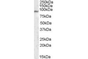 Image no. 1 for anti-Mediator Complex Subunit 15 (MED15) (both Isoforms), (Internal Region) antibody (ABIN375100) (MED15 抗体  (both Isoforms, Internal Region))