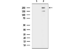 Western blot analysis of lysates from MC-3-E1 cells(H2O2 treatment), using KMG/hSEB Antibody.