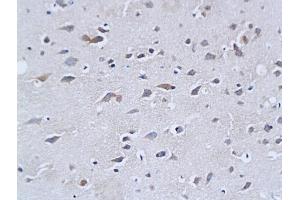 Formalin-fixed and paraffin embedded mouse brain tissue labeled with Rabbit Anti-NF-H/Neurofilament H/Neurofilament 200 Polyclonal Antibody (ABIN672156), Unconjugated followed by conjugation to the secondary antibody and DAB staining (NEFH 抗体  (AA 1-100))