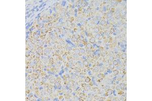 Immunohistochemistry (IHC) image for anti-Acyl-CoA Dehydrogenase, Long Chain (ACADL) (AA 31-210) antibody (ABIN1678519)