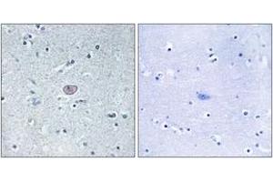Immunohistochemistry (IHC) image for anti-VEGF Receptor 2 (VEGFR2) (AA 917-966) antibody (ABIN2889081) (VEGFR2/CD309 抗体  (AA 917-966))