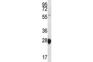 RAB27B antibody western blot analysis in MDA-MB435 lysate. (RAB27B 抗体  (AA 121-150))