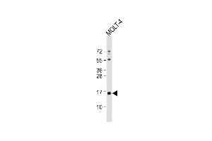 Anti-CRABP1 Antibody (C-term) at 1:1000 dilution + MOLT-4 whole cell lysate Lysates/proteins at 20 μg per lane. (CRABP1 抗体  (C-Term))