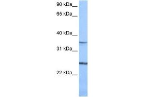 PIGF antibody used at 1 ug/ml to detect target protein. (PIGF 抗体  (N-Term))