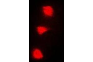 Immunofluorescent analysis of SPZ1 staining in A549 cells. (SPZ1 抗体  (N-Term))