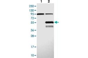 Western blot analysis of Lane 1: Negative control (vector only transfected HEK293T lysate), Lane 2: Over-expression Lysate (Co-expressed with a C-terminal myc-DDK tag (~3. (ABHD2 抗体)