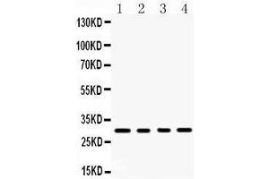 Western Blotting (WB) image for anti-Tumor Necrosis Factor (Ligand) Superfamily, Member 13b (TNFSF13B) (AA 134-285) antibody (ABIN3043751) (BAFF 抗体  (AA 134-285))