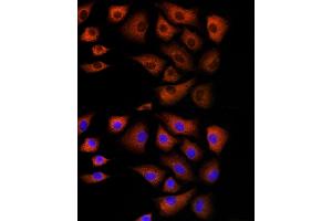 Immunofluorescence analysis of NIH/3T3 cells using DBI Rabbit pAb (ABIN6127407, ABIN6139420, ABIN6139422 and ABIN6217234) at dilution of 1:100 (40x lens). (Diazepam Binding Inhibitor 抗体  (AA 1-114))