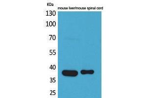 Western Blotting (WB) image for anti-Aldolase C, Fructose-Bisphosphate (ALDOC) (N-Term) antibody (ABIN3178215) (ALDOC 抗体  (N-Term))