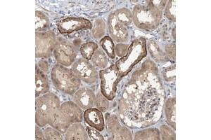 Immunohistochemical staining of human kidney with ZC3H12A polyclonal antibody  shows strong cytoplasmic positivity in cells in tubules at 1:200-1:500 dilution. (ZC3H12A 抗体)