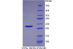 SDS-PAGE analysis of Human Interleukin 17 Protein.