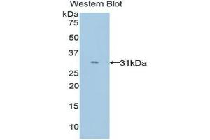 Detection of Recombinant MYO1E, Mouse using Polyclonal Antibody to Myosin IE (MYO1E) (MYO1E 抗体  (AA 772-1033))