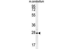 VSTM2A Antibody (Center) western blot analysis in mouse cerebellum tissue lysates (35 µg/lane). (VSTM2A 抗体  (Middle Region))