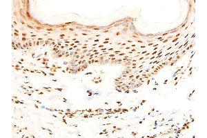 ABIN6267304 at 1/100 staining human skin tissue sections by IHC-P. (C-JUN 抗体  (pSer243))