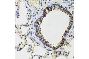 Immunohistochemistry (IHC) image for anti-Aconitase 1 (ACO1) antibody (ABIN1877037)