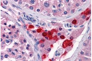Human Testis: Formalin-Fixed, Paraffin-Embedded (FFPE) (TWIST2 抗体  (AA 1-161))