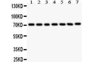 Anti- FOXO3A antibody, Western blotting All lanes: Anti FOXO3A  at 0. (FOXO3 抗体  (AA 471-673))