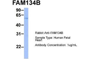 Host:  Rabbit  Target Name:  FAM134B  Sample Type:  Human Fetal Heart  Antibody Dilution:  1. (FAM134B 抗体  (Middle Region))