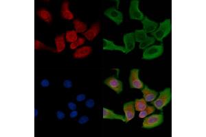 ABIN6263290 and ABIN6266589 staining HepG2 cells by IF/ICC. (MMP1 抗体  (C-Term))