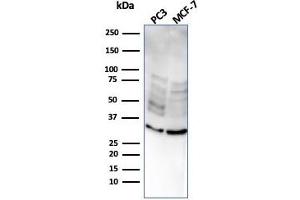 Western Blot Analysis of PC3 and MCF-7 cell lysate usingNKX2. (NKX2-8 抗体  (AA 10-123))