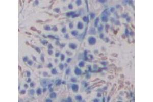 IHC-P analysis of Human Tissue, with DAB staining. (UGT8 抗体  (AA 198-541))