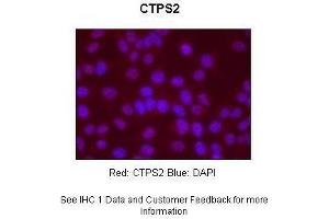 Sample Type : Human Hep-2 cells Primary Antibody Dilution : 1:500 Secondary Antibody : Goat anti-rabbit-Alexa Fluor 568 Secondary Antibody Dilution : 1:400 Color/Signal Descriptions : Red: CTPS2 Blue: DAPI Gene Name : CTPS2 Submitted by : S. (CTPS2 抗体  (N-Term))