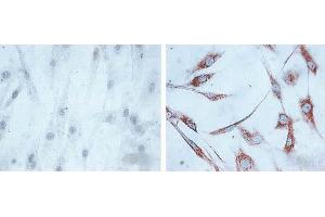 IHC of human skin fibroblasts (Left: control, Right: 24 hours after 7th passage of senescence). (HSPD1 抗体)