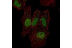 Immunofluorescence analysis of HeLa cells using MAP2K7 monoclonal antibody, clone 4E5  (green). (MAP2K7 抗体)